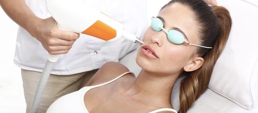 Refacerea pielii cu laser